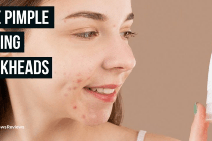 acne pimple popping blackheads