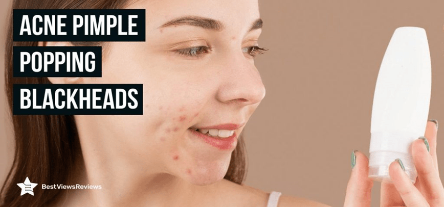 acne pimple popping blackheads